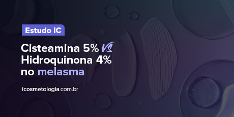 Cisteamina 5% vs Hidroquinona 4% no melasma