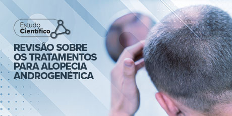 Revisão sobre os Tratamentos para Alopecia Androgenética