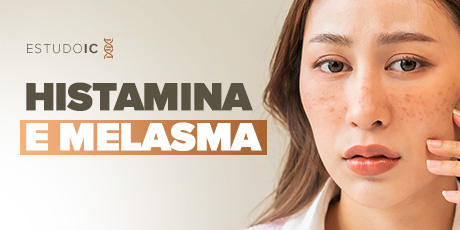 Histamina e Melasma