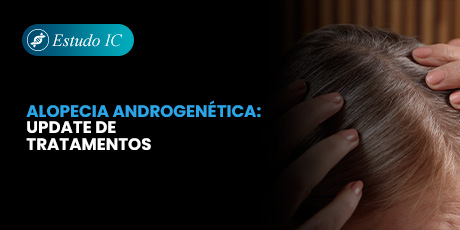 Estratégias Combinadas na Alopecia Androgenética