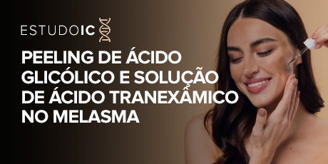 Peeling de Ácido Glicólico e Solução de Ácido Tranexâmico no Melasma