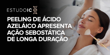 Peeling de Ácido Azeláico Apresenta Ação Sebostática de Longa Duração