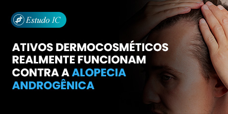 Ativos dermocosméticos realmente funcionam contra a alopecia androgênica?