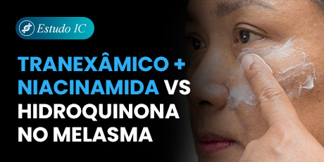 Tranexâmico+ Niacinamida vs Hidroquinona no Melasma