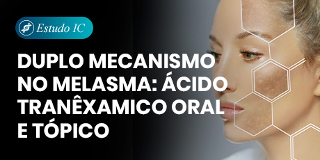 Duplo mecanismo no melasma: ácido tranêxamico oral e tópico