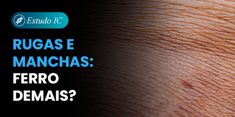 Rugas e Manchas: Ferro demais?
