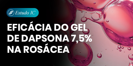 Eficácia do gel de dapsona 7,5% na rosácea