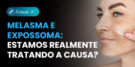Melasma e Expossoma: estamos realmente tratando a causa?
