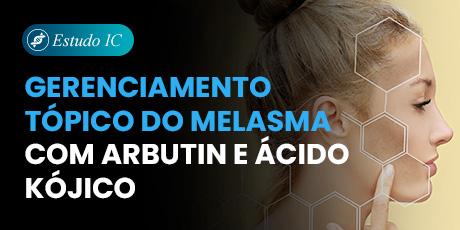 Alfa-Arbutin e Ácido Kójico como Alternativa à Terapia Tripla no Melasma