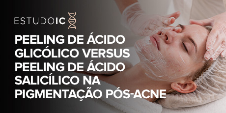 Peeling de Ácido Glicólico versus Peeling de Ácido Salicílico na Pigmentação Pós-Acne