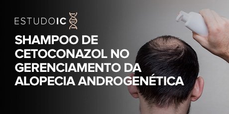 Shampoo de Cetoconazol no Gerenciamento da Alopecia Androgenética