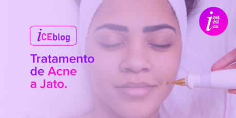 Tratamento de Acne a Jato