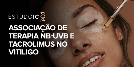 Associação de Terapia Nb-UVB e Tacrolimus no Vitiligo