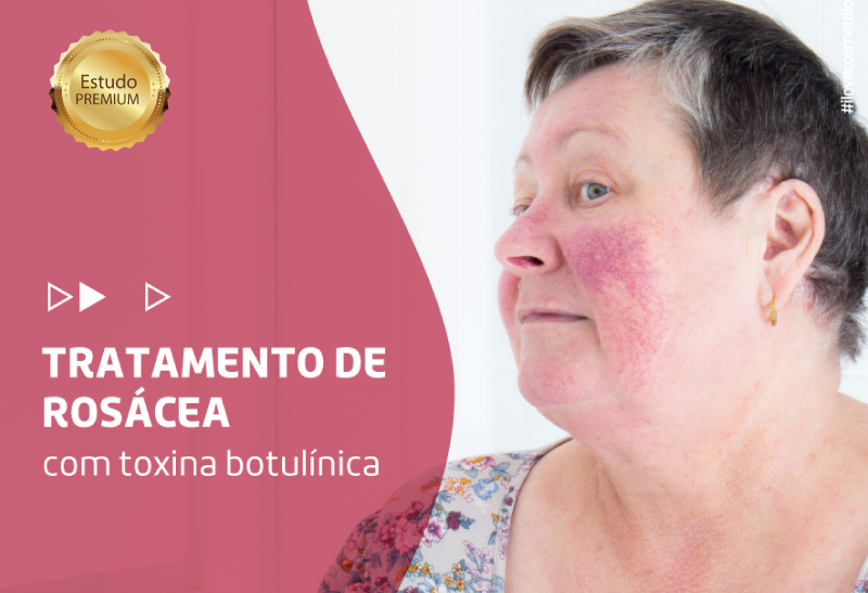 Estudo prospectivo para tratamento do rubor da rosácea com toxina botulínica tipo A