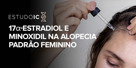 17a-estradiol e Minoxidil na Alopecia Padrão Feminino